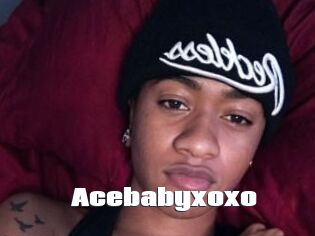 Acebabyxoxo